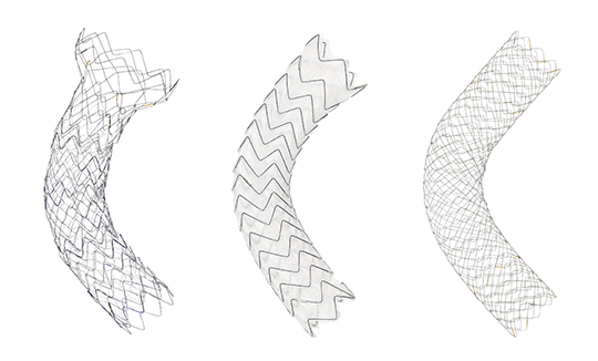 左からスプライダー胃十二指腸ステント、ジャバラ大腸ステント、Bactrian大腸ステント