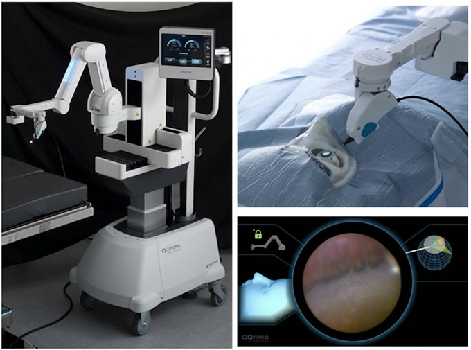眼内内視鏡保持ロボット「OQrimo」を用いた周辺部網膜観察　（左）OQrimoの外観。（右上）OQrimoに保持された眼内内視鏡を模型眼に挿入した様子。（右下）OQrimoに保持された内視鏡による周辺部網膜の実際の観察画像。