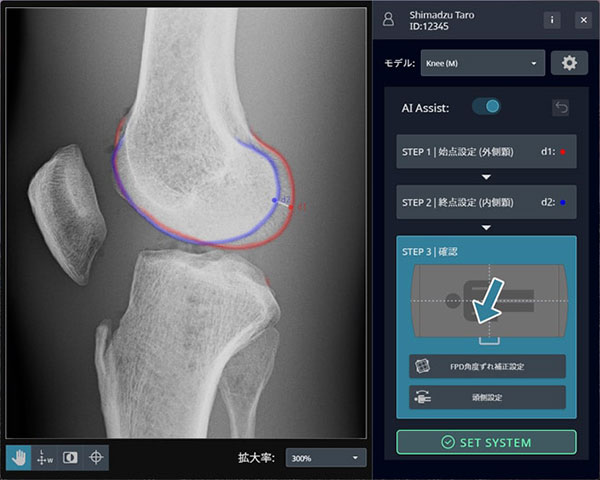 「Ortho-Navi」の画面。矢印でX線管保持器が移動する方向を示している