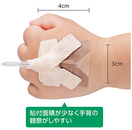 固定した様子