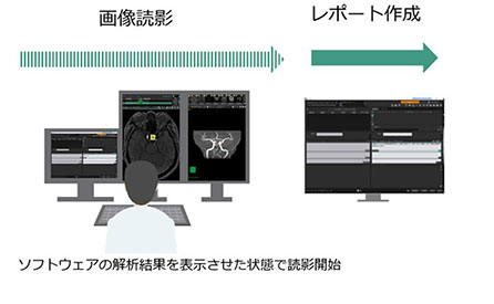 コンカレントリード型利用時の読影ワークフロー
