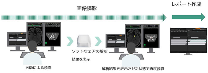 セカンドリード型利用時の読影ワークフロー