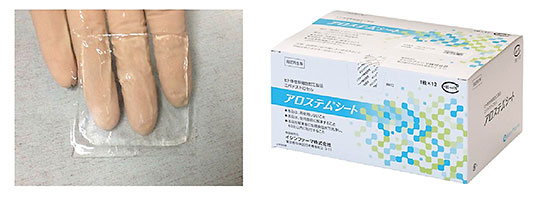 アロステムシート 左がシート