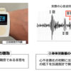 治験で使用するウェアラブルデバイス(電子聴診器機能と活動量測定機能を用いて心不全悪化の兆候を検出する)