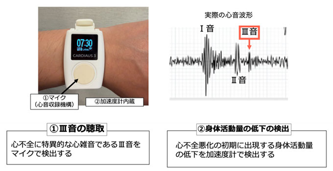 治験で使用するウェアラブルデバイス(電子聴診器機能と活動量測定機能を用いて心不全悪化の兆候を検出する)